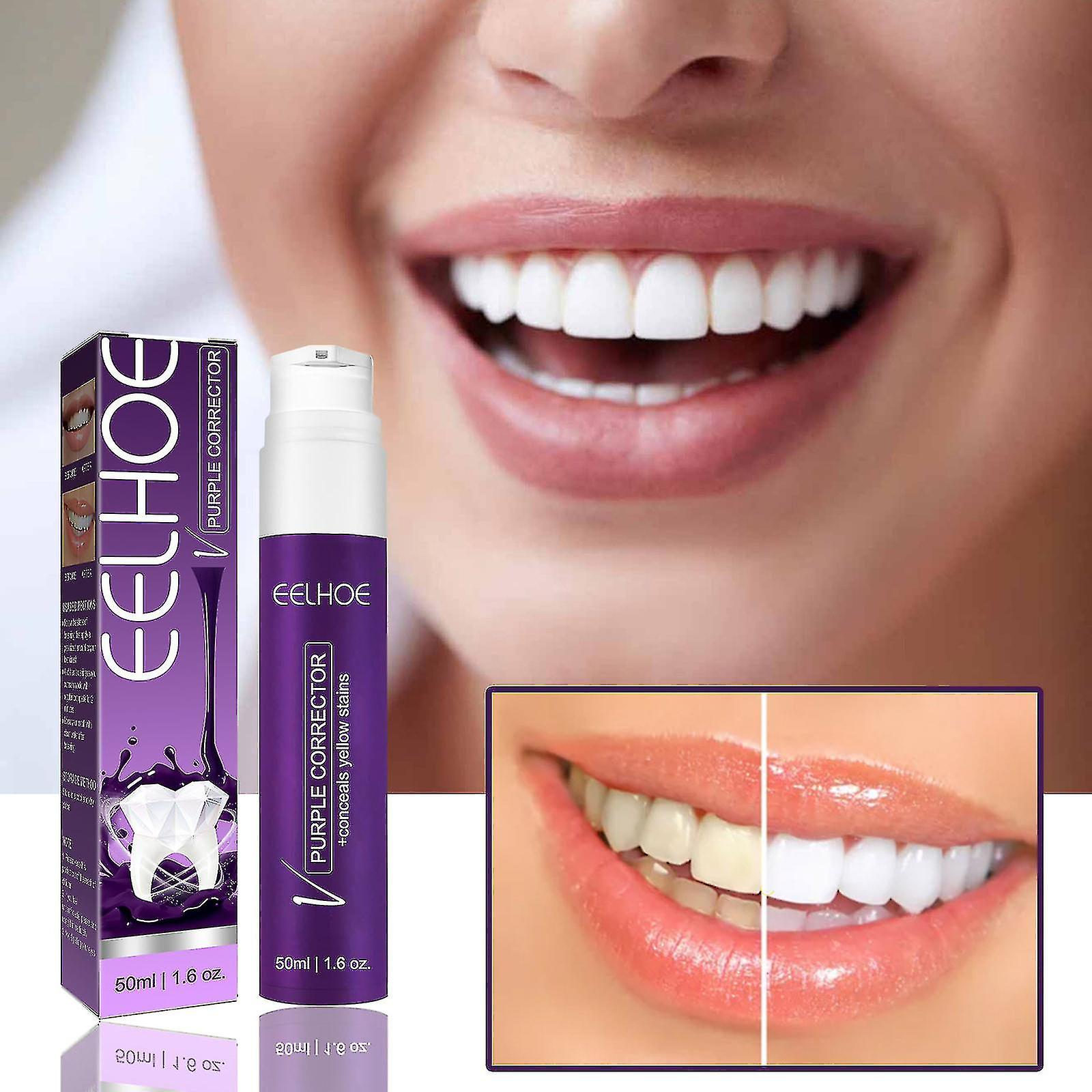 Teeth Whitening
